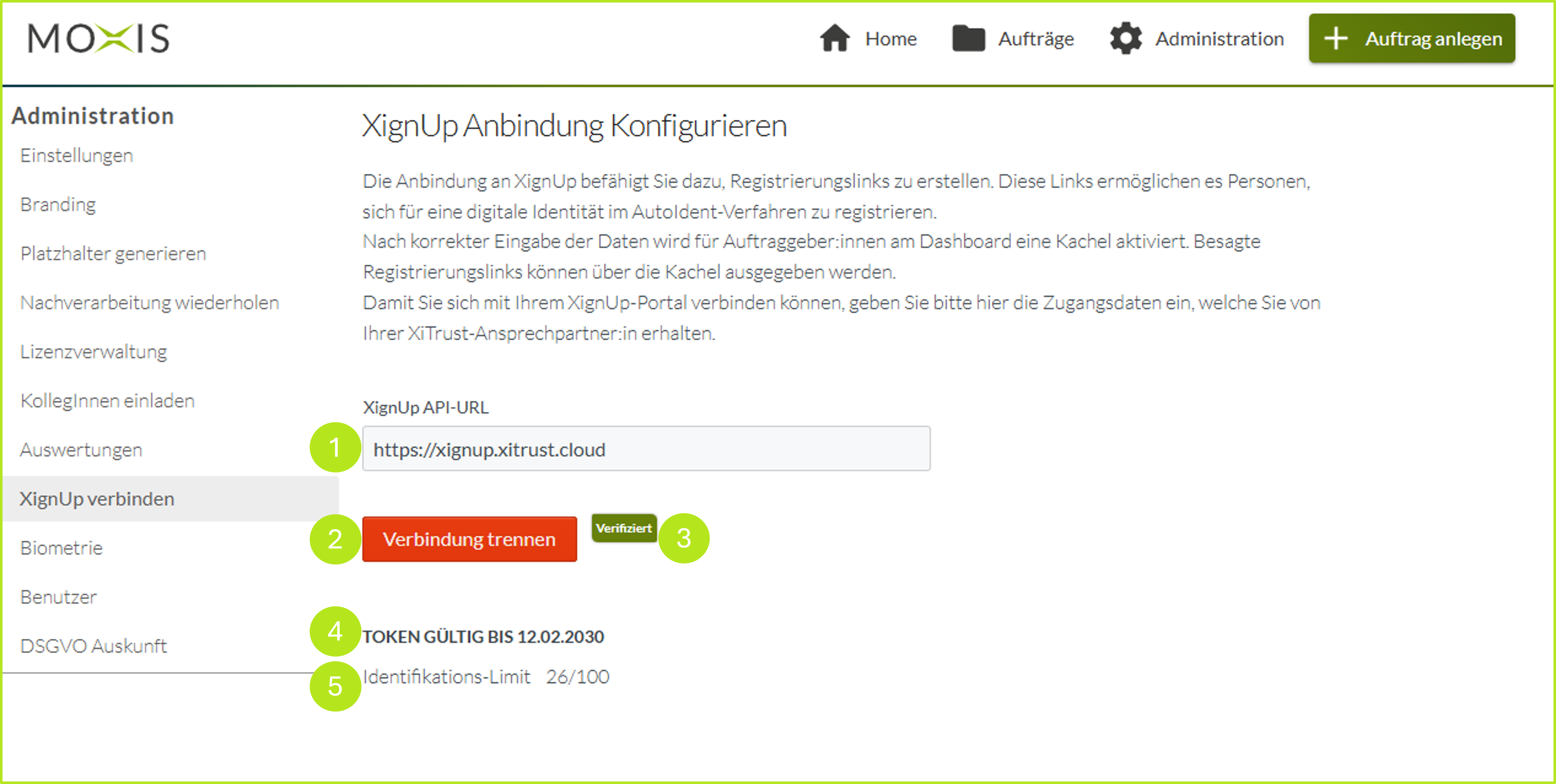 02_XignUp_angelegt.png